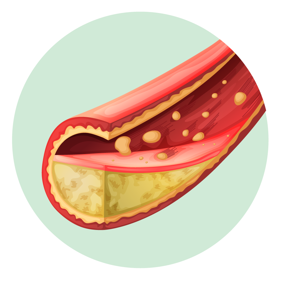 private cholesterol test